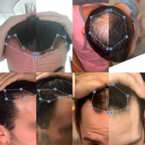 Image of BODYWISE® - Activa folículos y recupera tu cabello y barba 10ml.