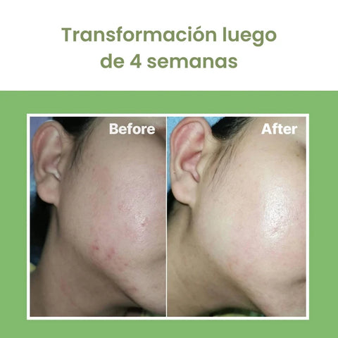 Image of NONI AMPOULE® - El secreto de una piel de porcelana
