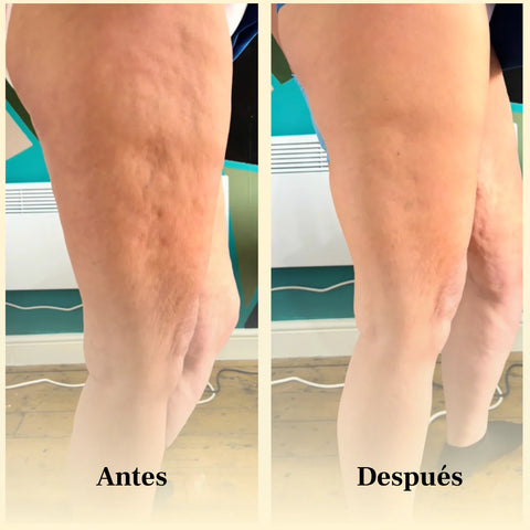Image of REVIVAL OIL® - Aceite anti-celulitis