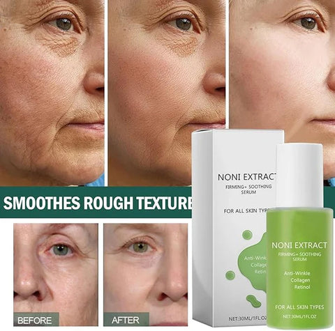 Image of SERUM NONI™ - El secreto de una piel de porcelana