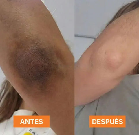 Image of GMEELAN® - Gel Exfoliante de Naranja